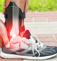 Foot Braces