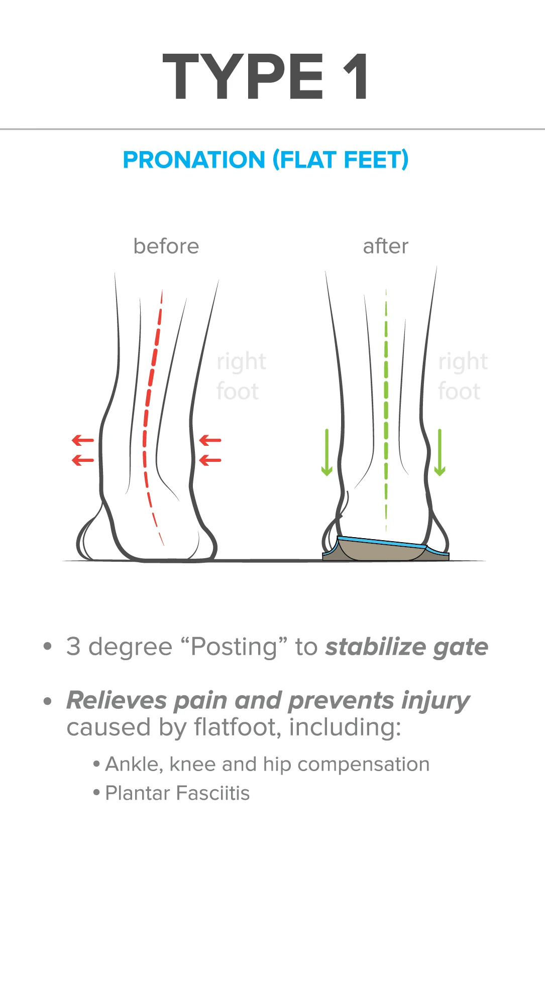 FootScientific Arches Specialty Orthotics - ARC-0017